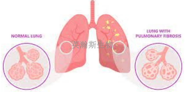 上海大鼠肺纤维化模型有哪家,肺纤维化模型