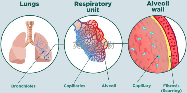 福建靠谱的肺纤维化模型是哪家,肺纤维化模型