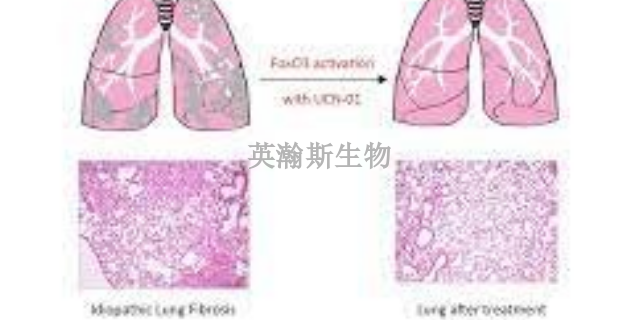 内蒙古靠谱的肺纤维化模型动物实验外包,肺纤维化模型